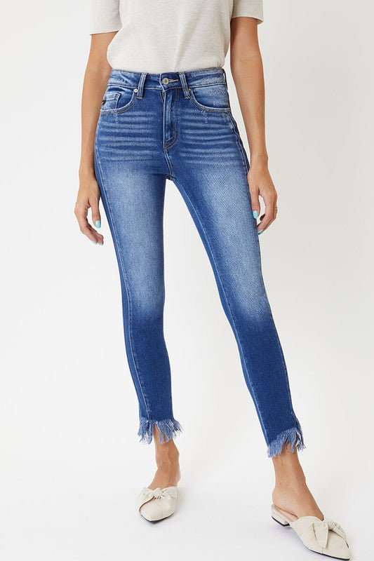 Dames Skinny Jeans Hoge Taille met Zoomdetail 1