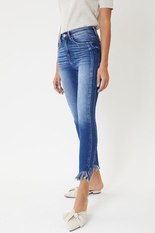 Dames Skinny Jeans Hoge Taille met Zoomdetail 2