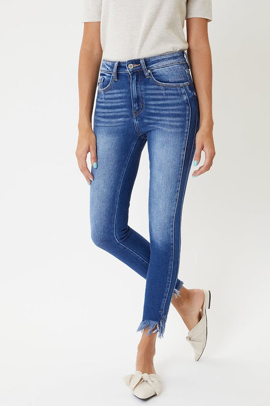 Dames Skinny Jeans Hoge Taille met Zoomdetail 4