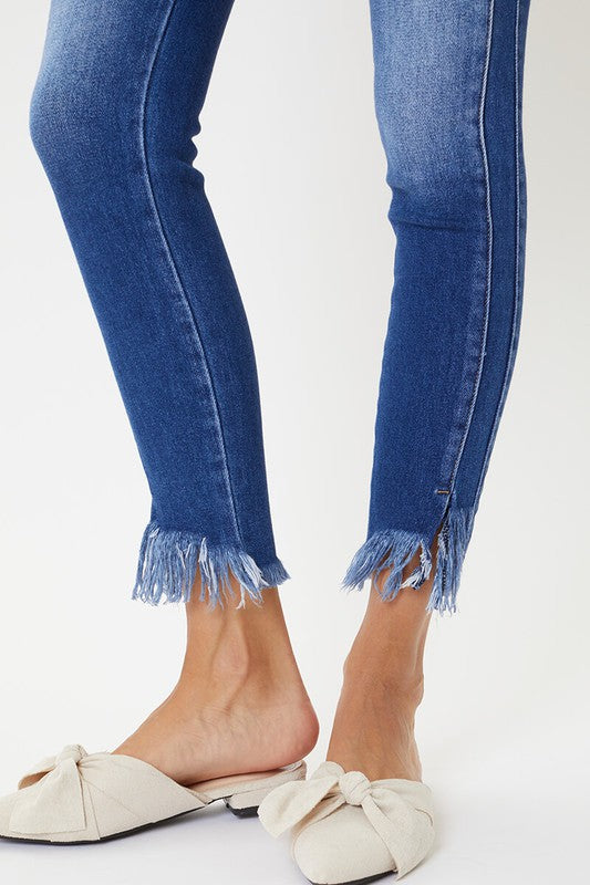 Dames Skinny Jeans Hoge Taille met Zoomdetail 5